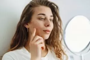 young woman checking her cheek acne on a mirror