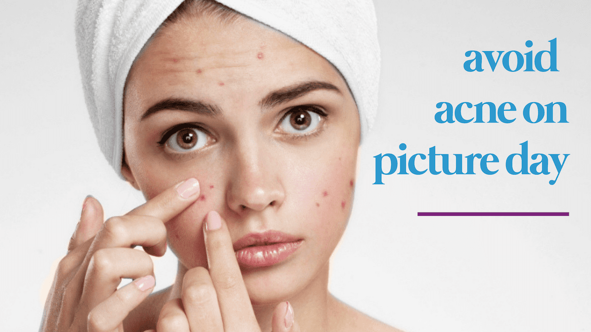 birth control that reduces acne