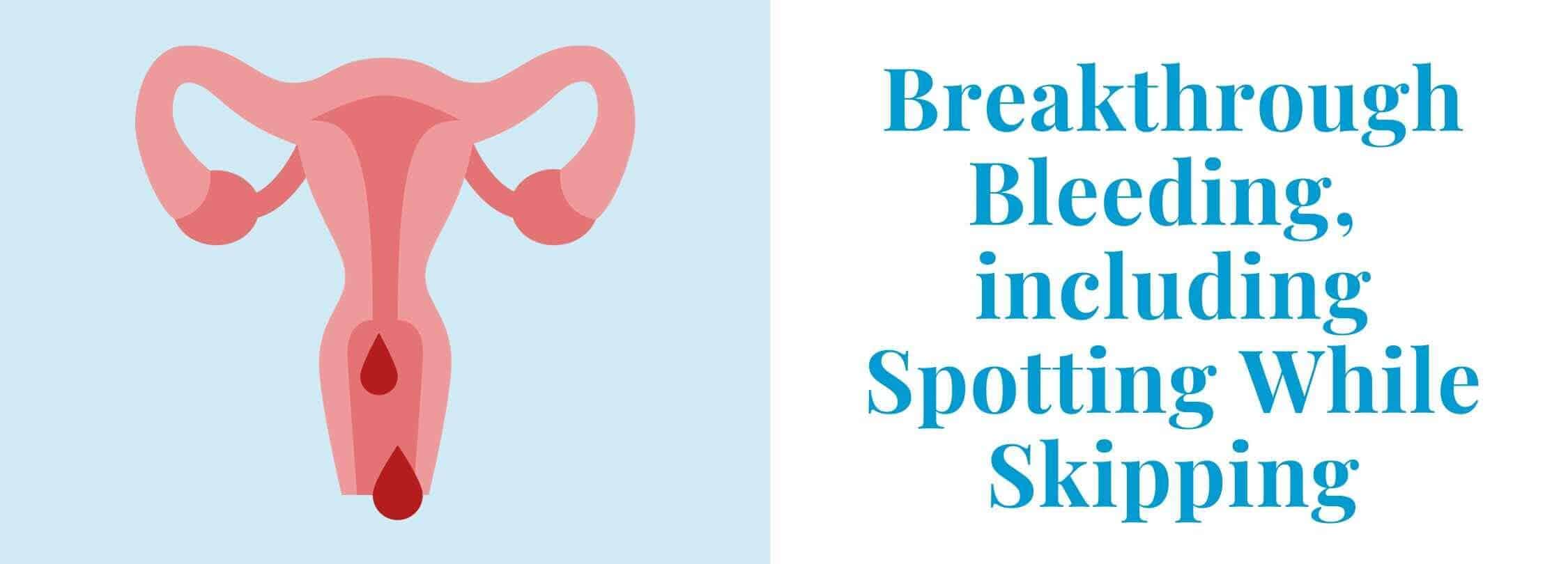 Light Bleeding On Sale Mid Cycle