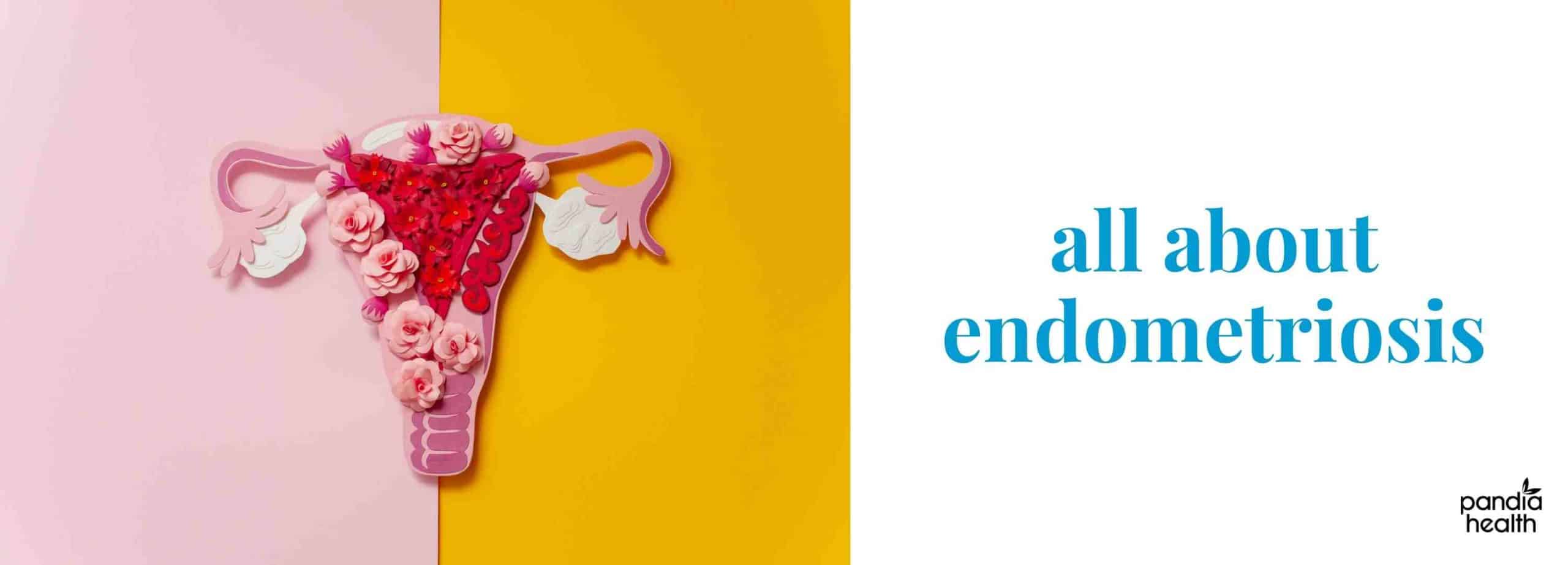 All about endometriosis