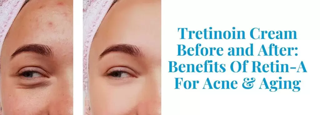 Tretinoin Before & After: Benefits Of Retin-A- Pandia Health