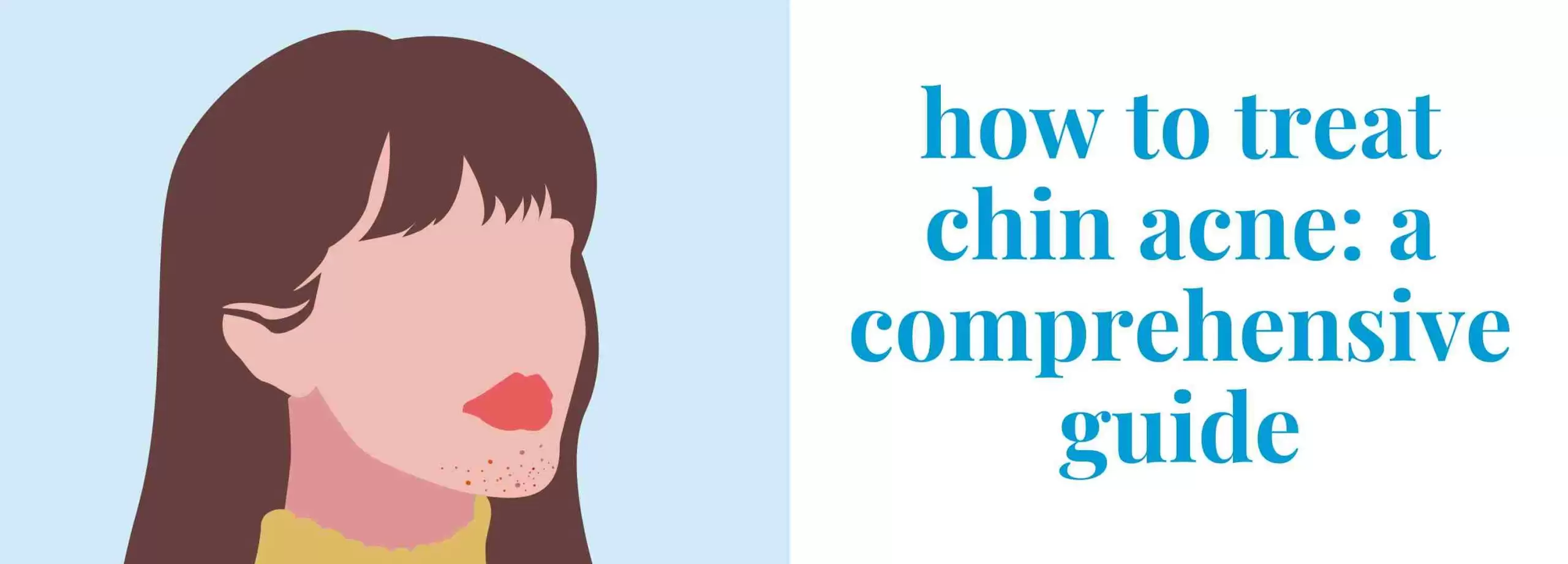 How to treat chin acne: a comprehensive guide