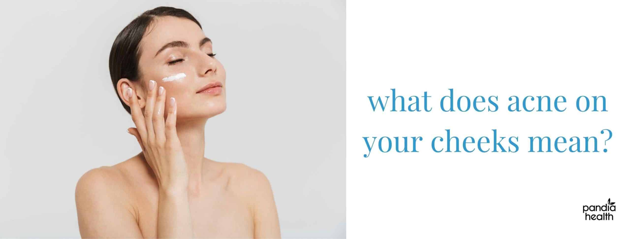 what does acne in your cheeks means