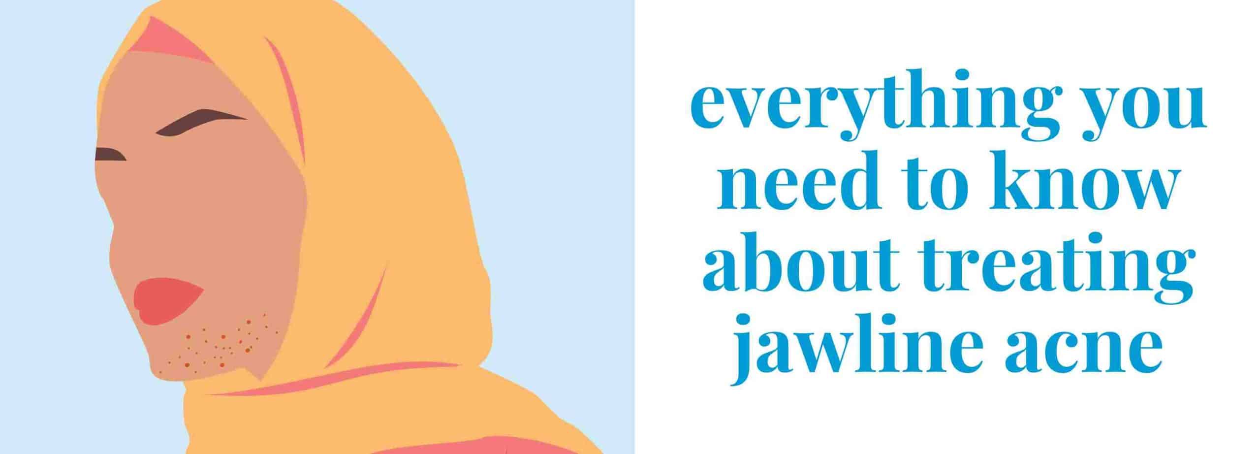 Everything you need to know about treating jawline acne