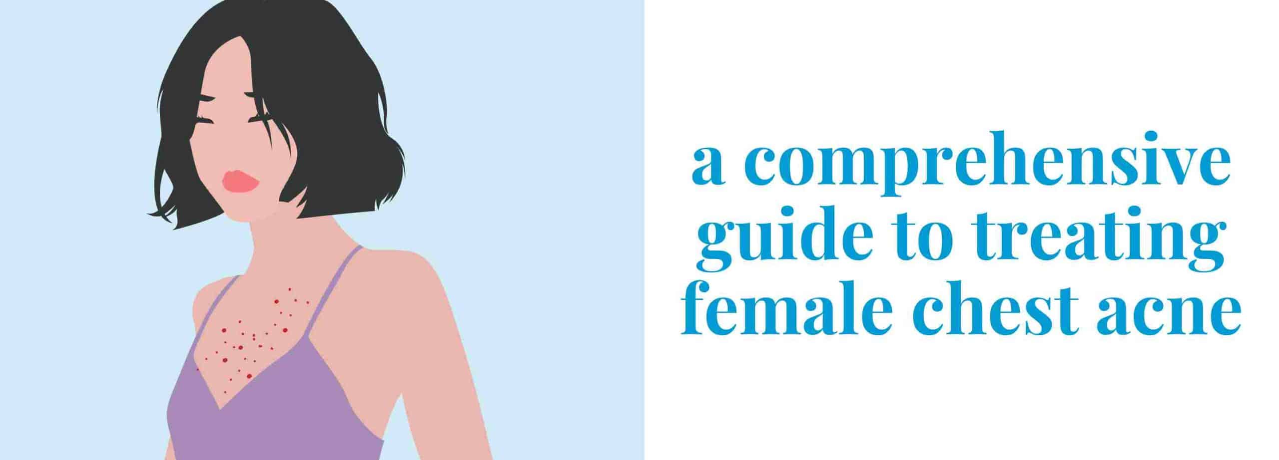 a comprehensive guide to treating female chest acne