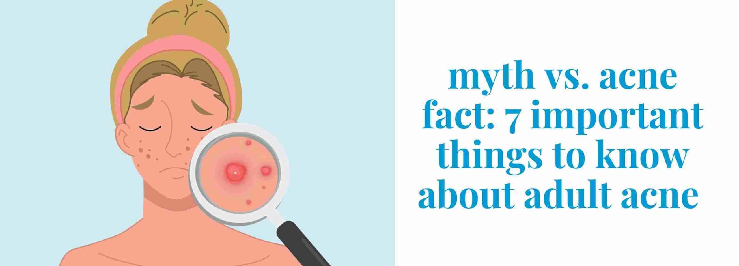 myth vs acne facts: 7 important things to know about adult acne