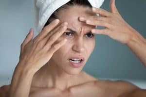 An unhappy woman trying to pop a pimple on her forehead