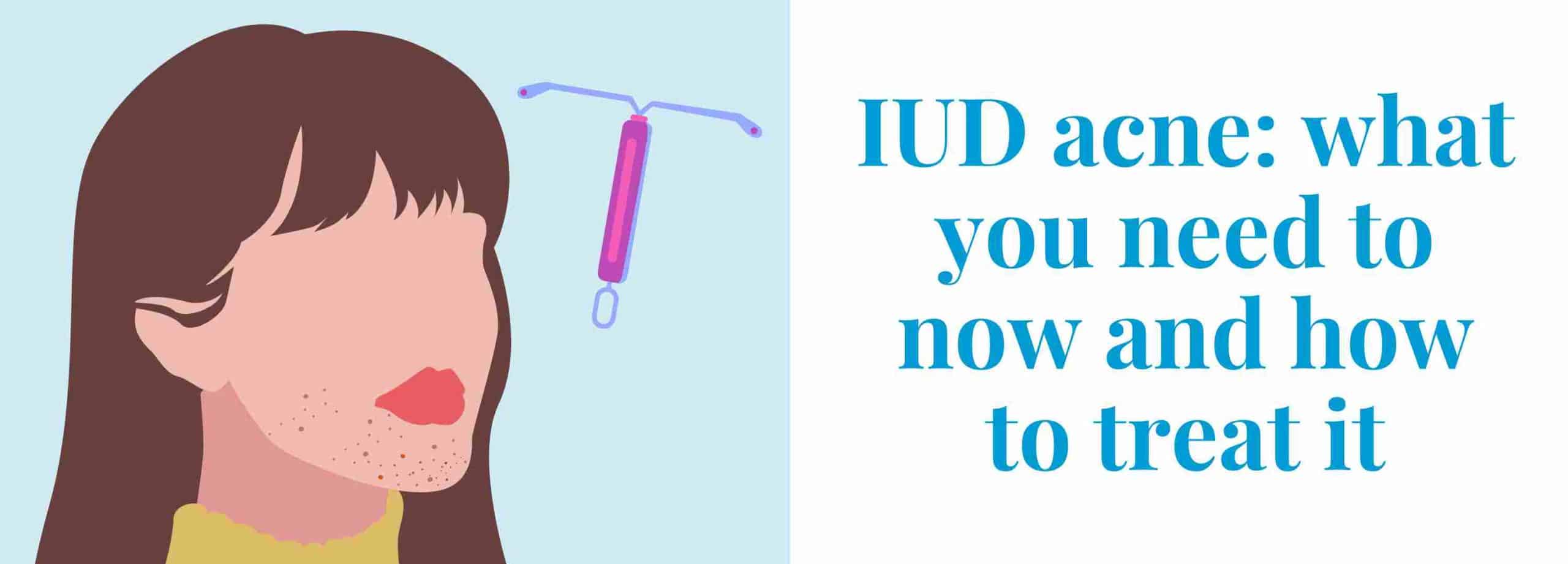 IUD Acne How IUDs Can Cause Acne, And How To Treat It