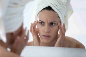 unhappy woman wearing white bath towel checking skin after shower, looking in mirror, worried about acne on temples